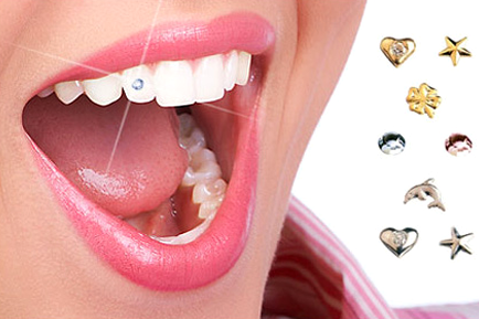 Tooth jewellery